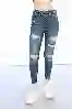 Resim Koyu Mavi Lazer Detaylı Skinny Jeans